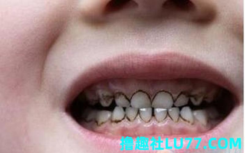梦见婴儿牙齿 梦见婴儿牙齿