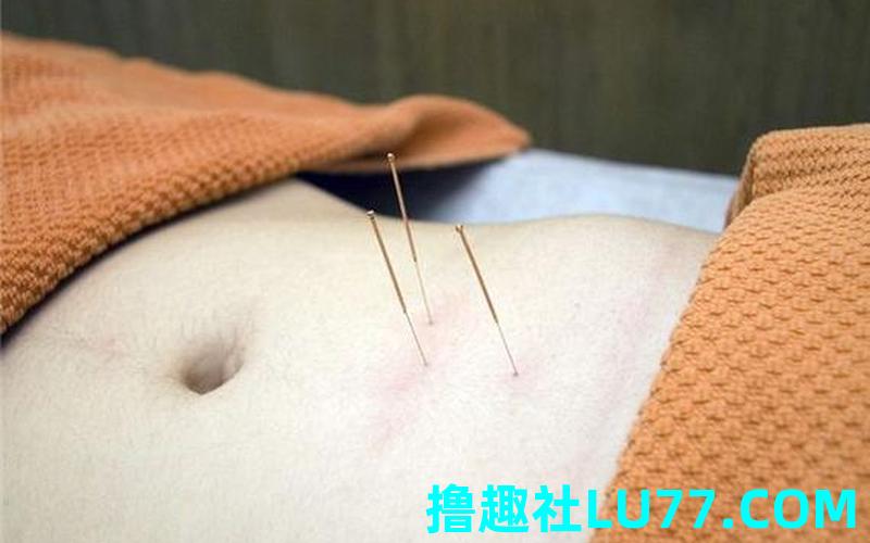 梦见针刺我