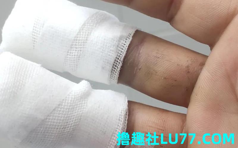 梦见手指接骨
