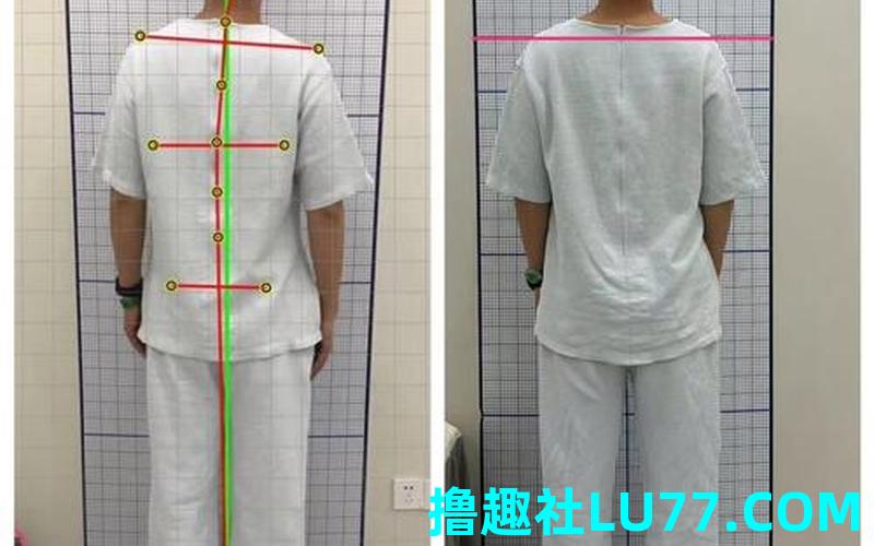 梦见脊椎弯了 梦见脊椎弯了