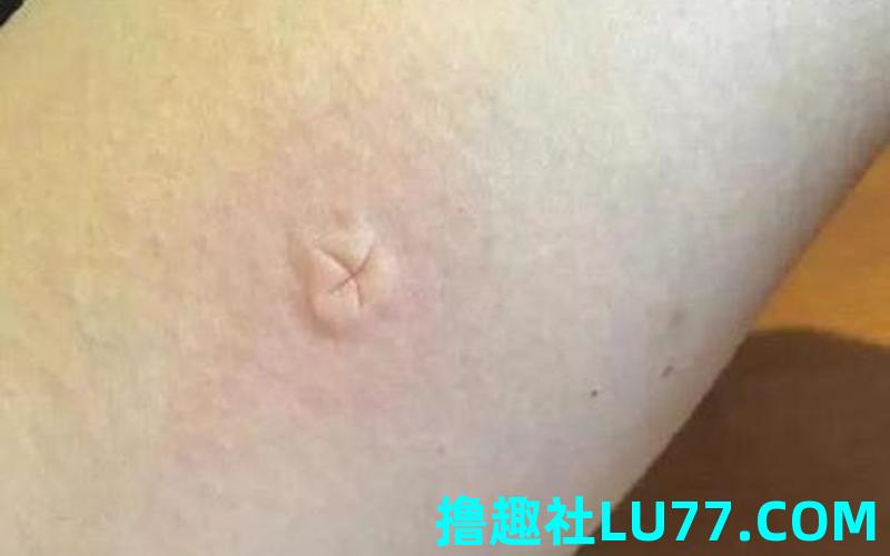 梦见鬼咬我