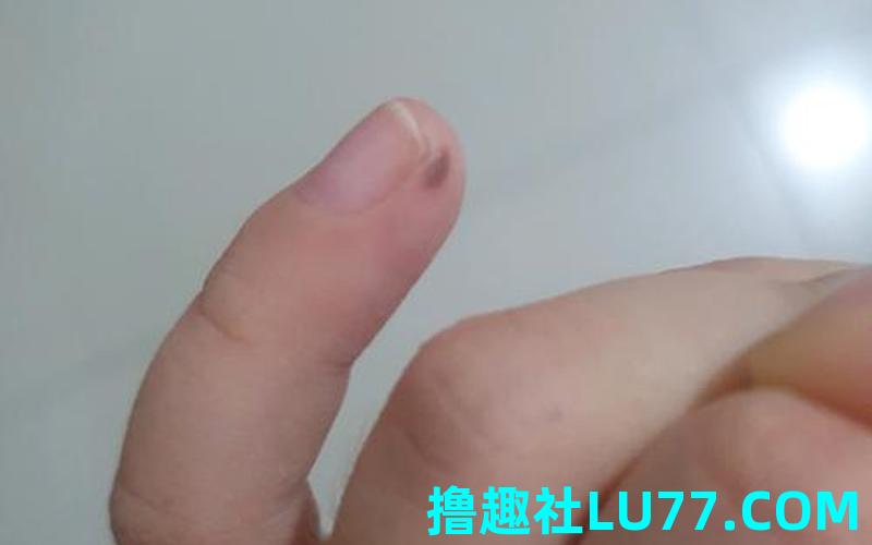 梦见多长了一个手指头 梦见多长了一个手指头