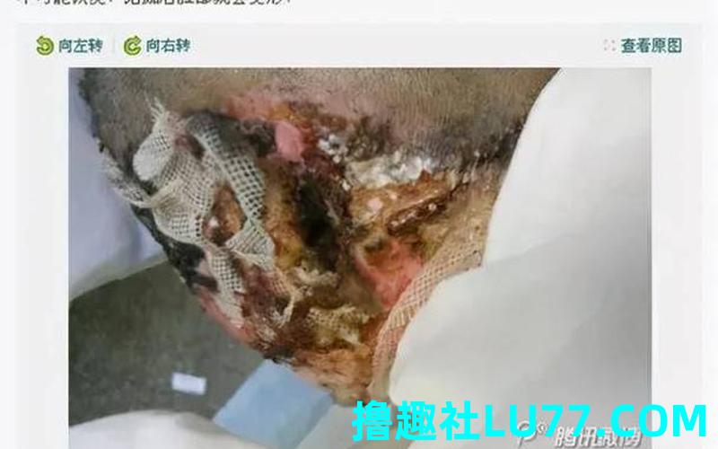 梦见自己的被毁容了 梦见自己的被毁容了