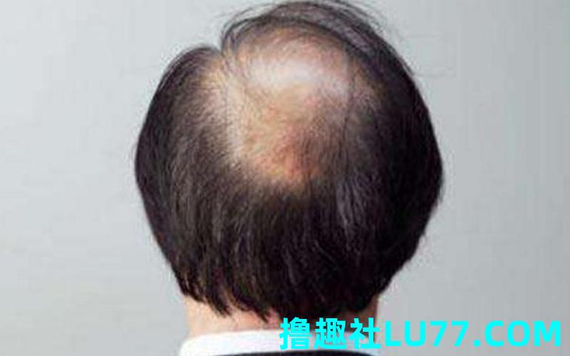 梦见被别人抢劫没成功