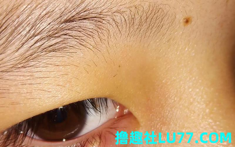 梦见眼生疮
