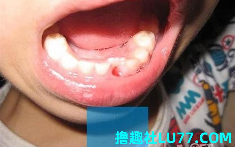 梦见爸爸掉牙什么预兆 梦见爸爸掉牙什么预兆