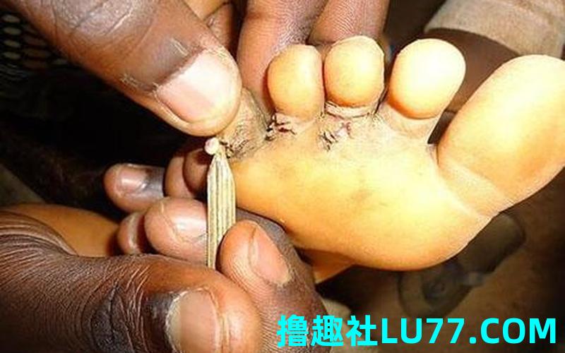 梦见身体里有虫子爬出来