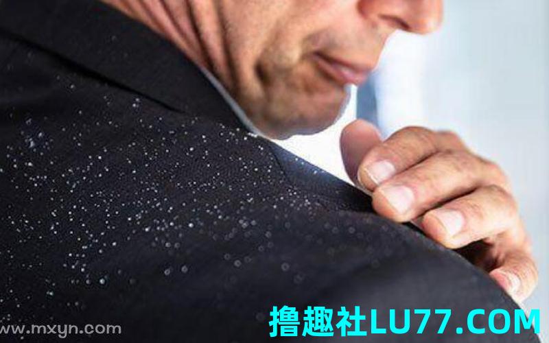 梦见头皮屑 梦见头皮屑