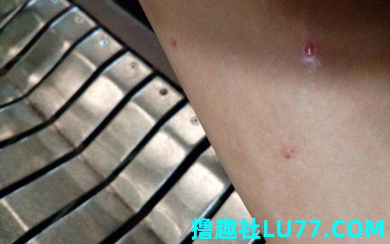 梦见别人身上有伤口