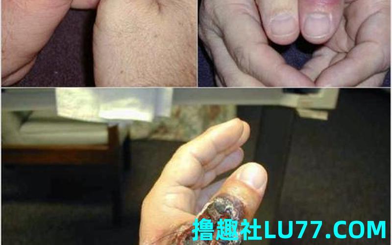 梦见红蜘蛛咬自己