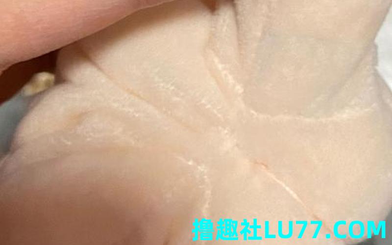 梦见臀肉裂 梦见臀肉裂
