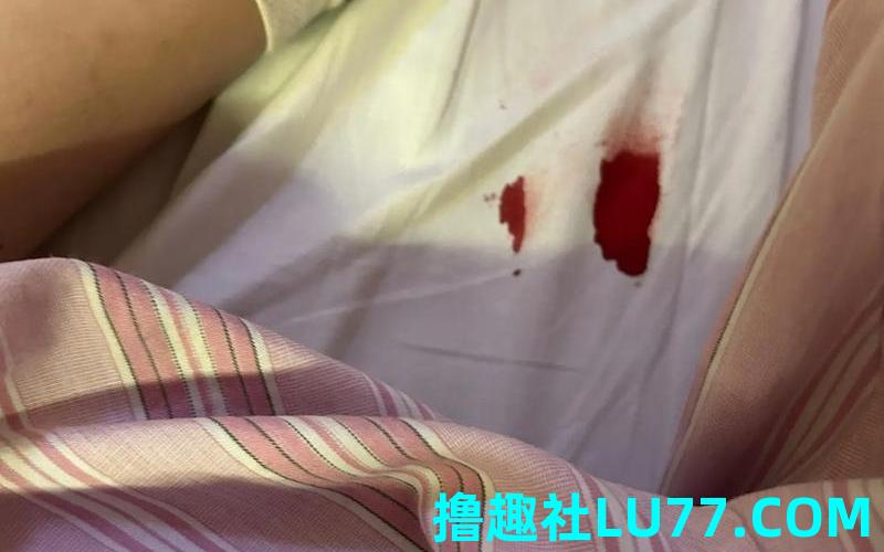 梦见自己浑身流血 梦见自己浑身流血