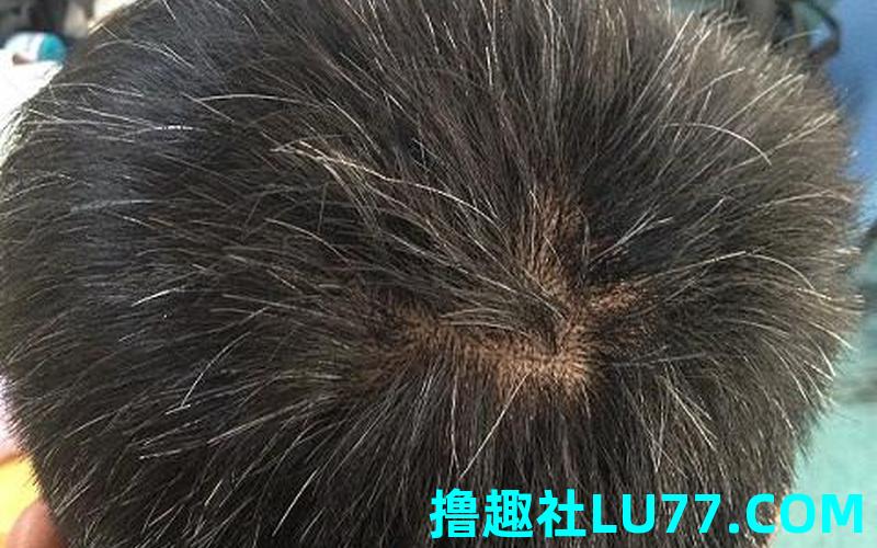 梦见老公头发长长了 梦见老公头发长长了