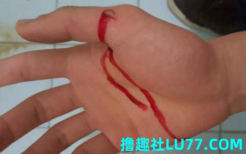 梦见老公手流血