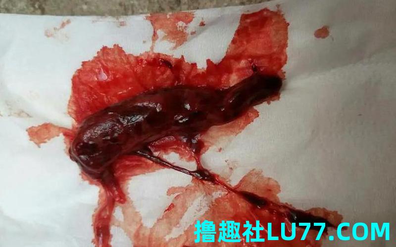 梦见流血几滴 梦见流血几滴