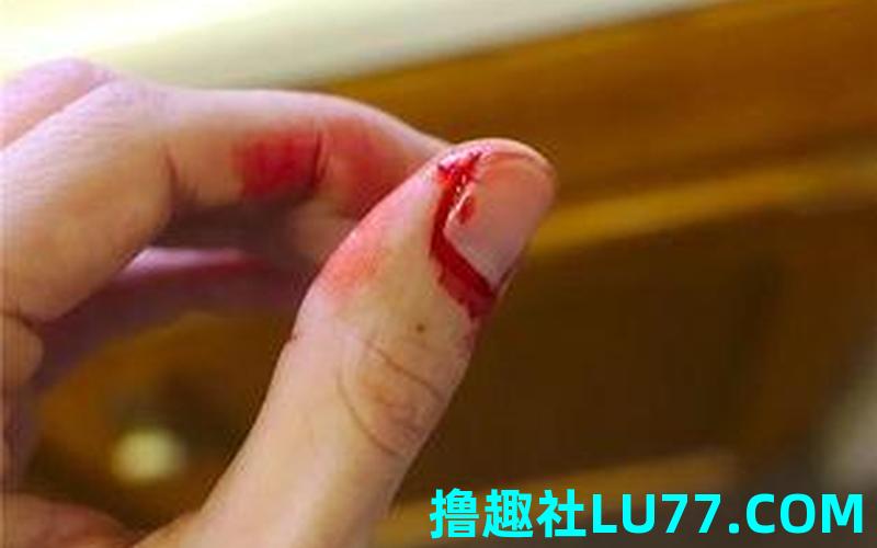 梦见自己的双手被 梦见自己的双手被