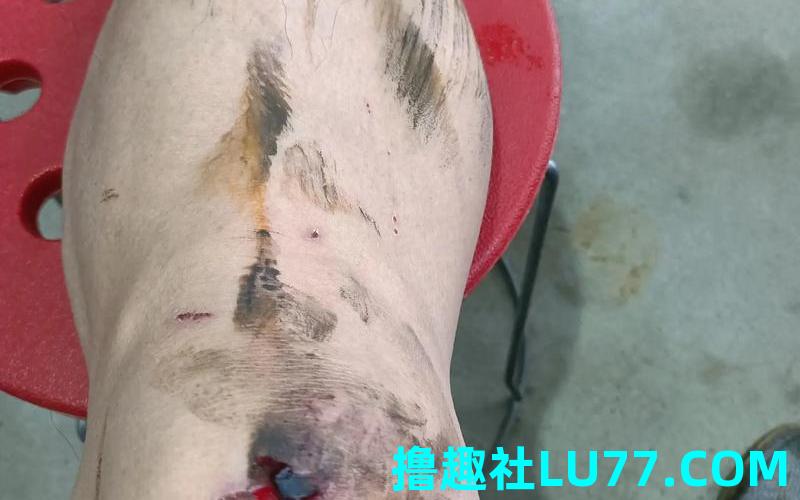 梦见老公腿受伤了