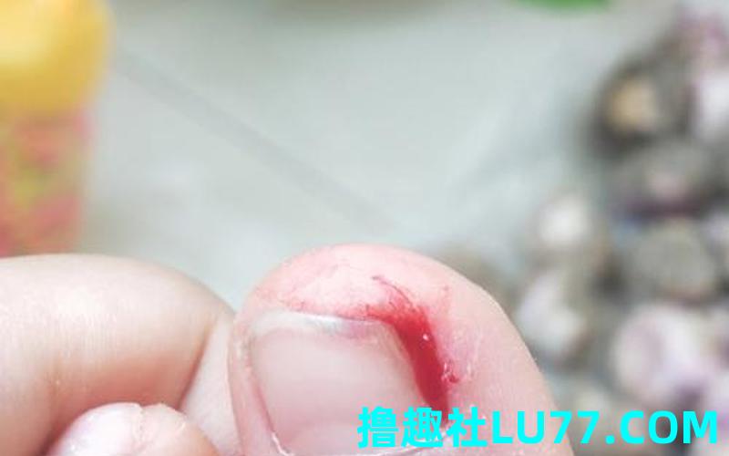 梦见脚指甲 剪的出血