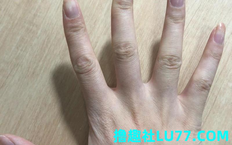 梦见手指歪