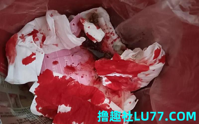 梦见自己口吐鲜血