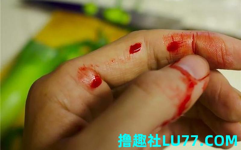 梦见手有血口