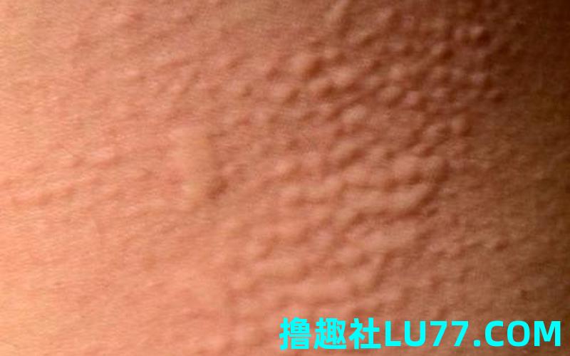 梦见起风团