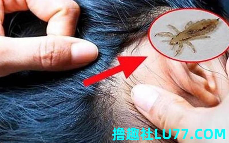 梦见虱子后代