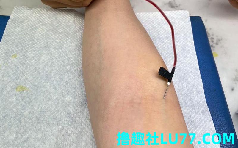 梦见针扎抽血