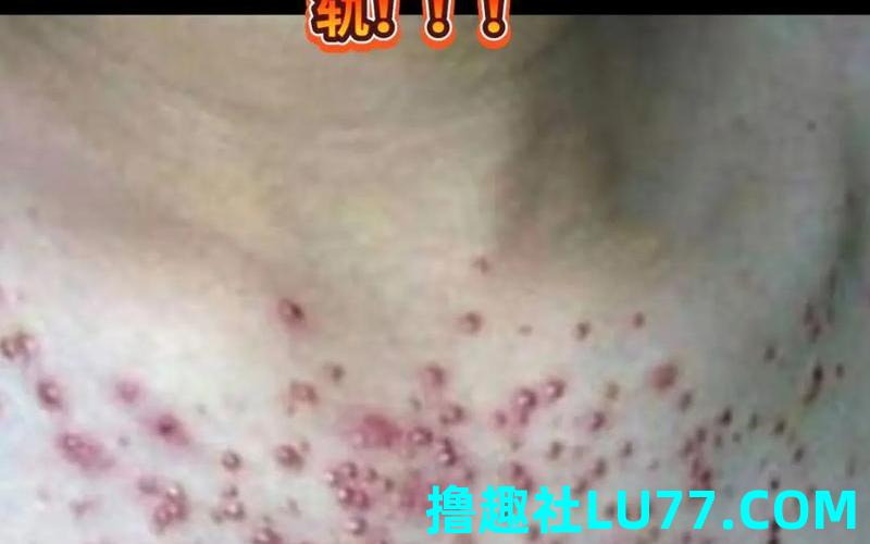 梦见自染毒 梦见自染毒
