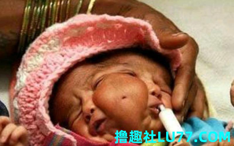 梦见生了个畸形孩子