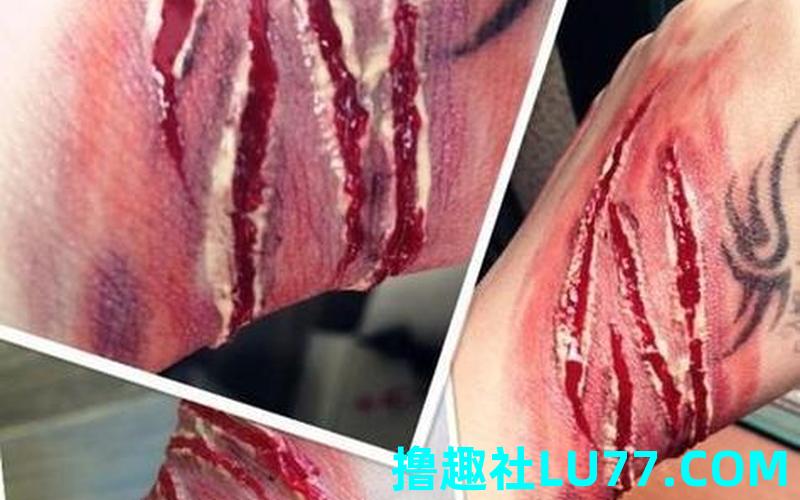梦见血喷脸上