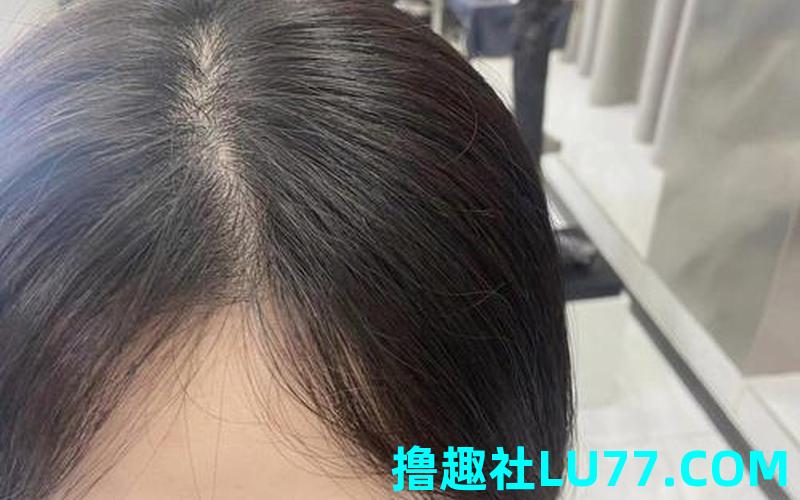梦见自己秃头刘海