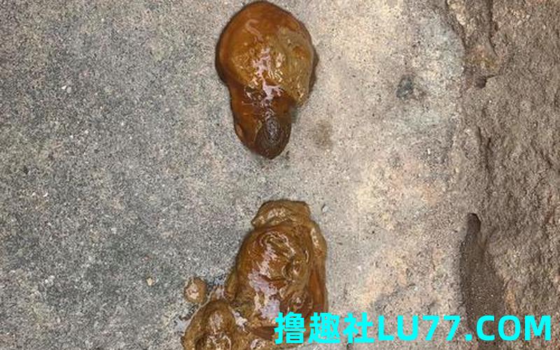梦见粪团 梦见粪团
