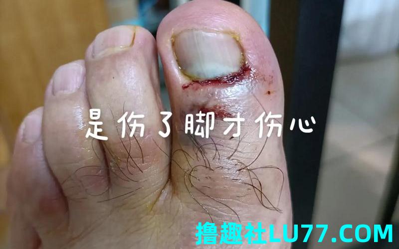 梦见脚被砍了