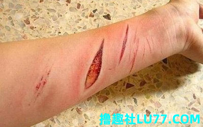 梦见流血不止