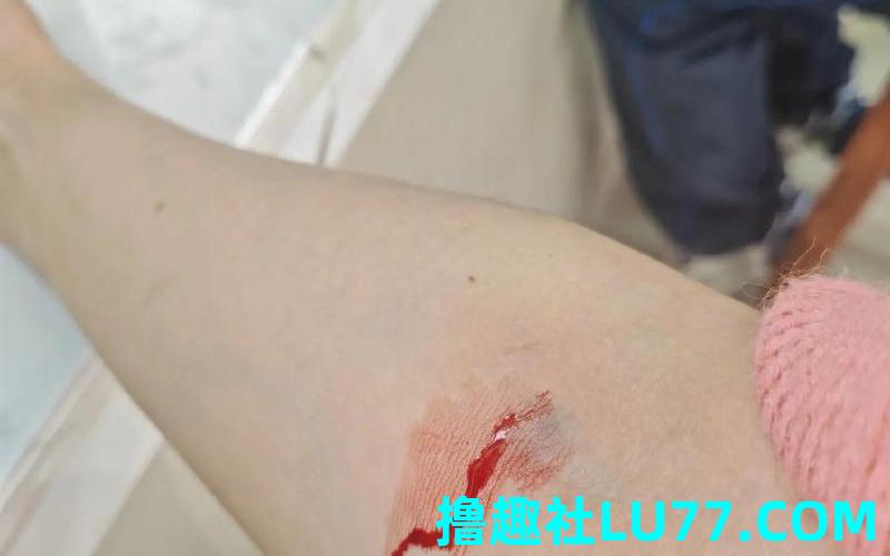 梦见自己腿上流了好多血 梦见自己腿上流了好多血