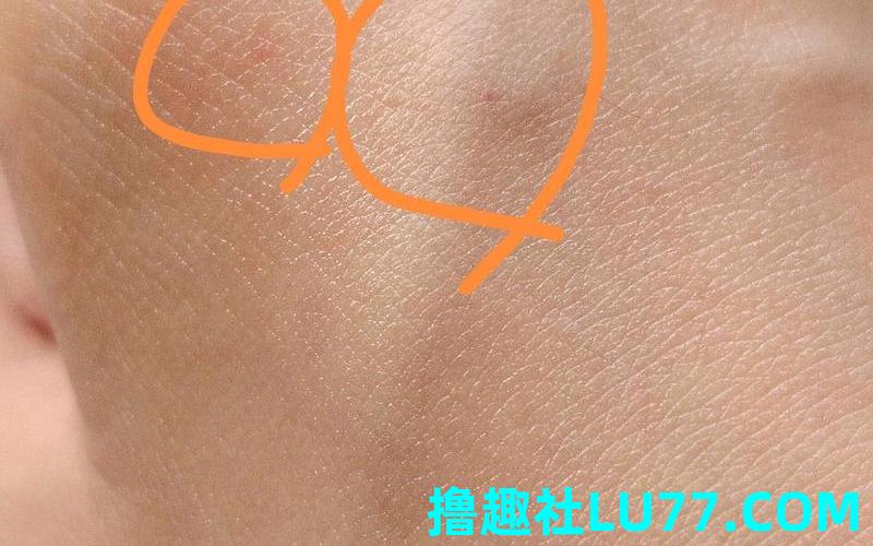 梦见被猫咬掉一块肉