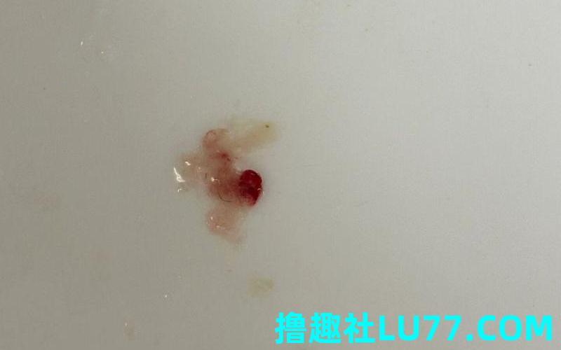 梦见咳血痰是什么意思