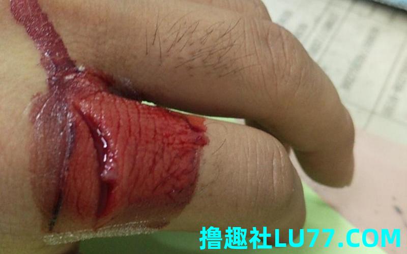 梦见钳子碎了 梦见钳子碎了