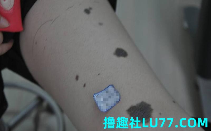 梦见身上长黑 毛 梦见身上长黑 毛