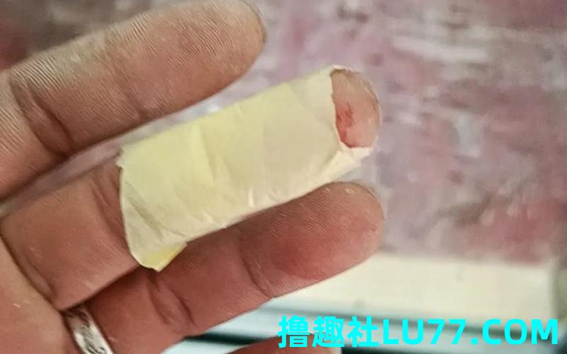 梦见扒自己皮