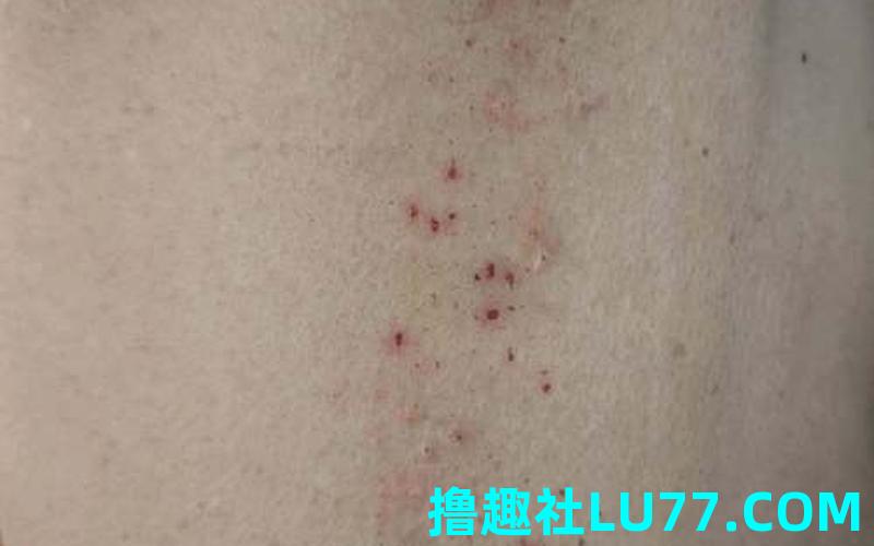 梦见缠腰