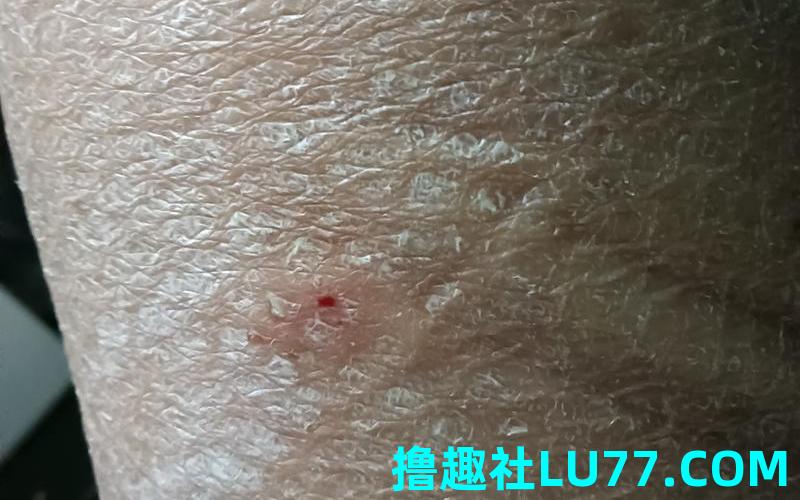 梦见身上掉鳞片 梦见身上掉鳞片