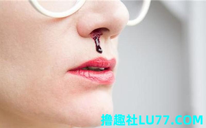 梦见自己流鼻血 梦见自己流鼻血