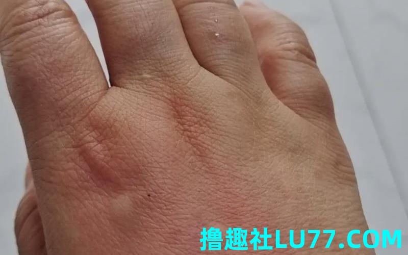 梦见被马咬到手 梦见被马咬到手