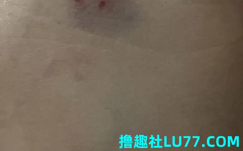 梦见被蛇咬了脸