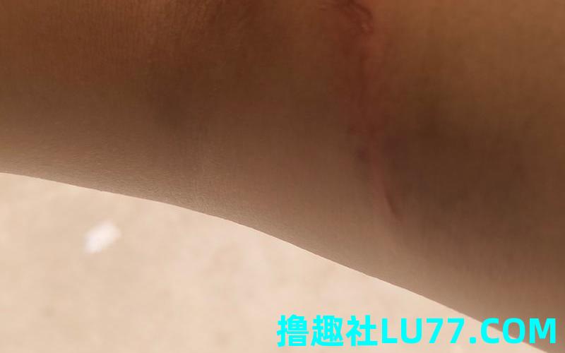 梦见被狗抓伤 梦见被狗抓伤