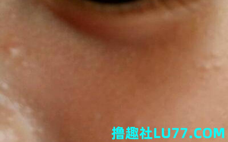 梦见鼻头白