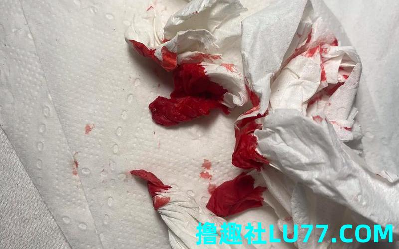 鼻子出血梦见 鼻子出血梦见