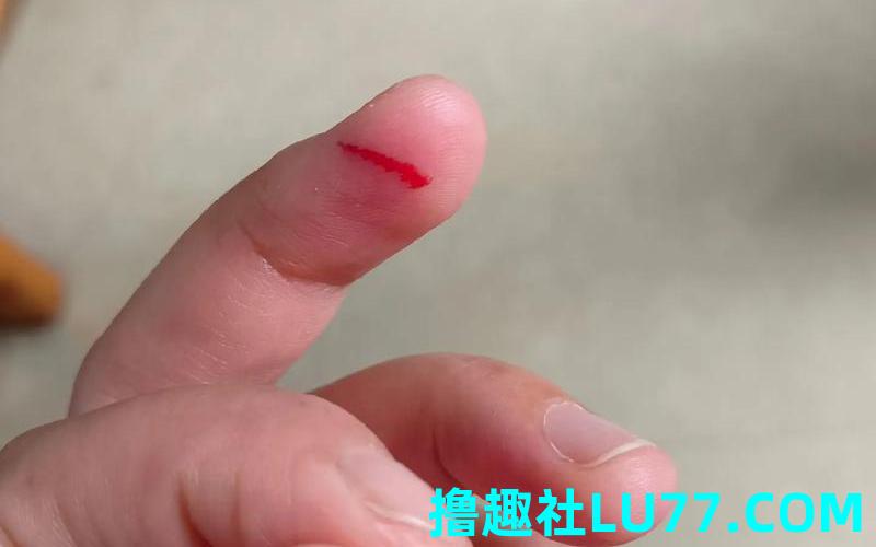 梦见手划破出血